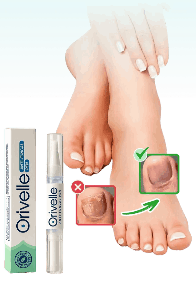 Orivelle Nail Fungus Pen – Official Site – Orievelle